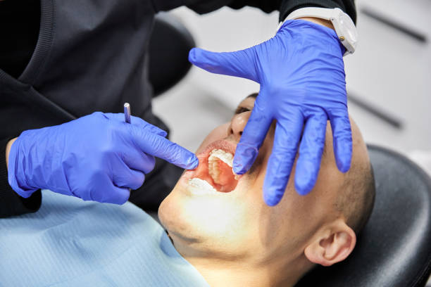 Best Emergency Treatment for Dental Infections or Abscesses in Chappaqua, NY